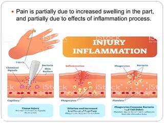  Pain is partially due to increased swelling in the part,
and partially due to effects of inflammation process.
 