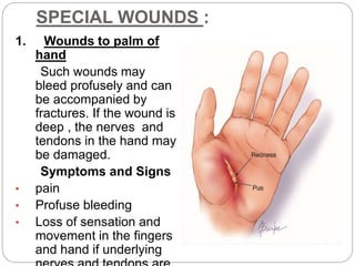 SPECIAL WOUNDS :
1. Wounds to palm of
hand
Such wounds may
bleed profusely and can
be accompanied by
fractures. If the wound is
deep , the nerves and
tendons in the hand may
be damaged.
Symptoms and Signs
• pain
• Profuse bleeding
• Loss of sensation and
movement in the fingers
and hand if underlying
 