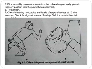 5. If the casuality becomes unconscious but is breathing normally ,place in
recovery position with the sound lung uppermost.
6. Treat shock.
7. Check breathing rate , pulse and levels of responsiveness at 10 mins.
Intervals. Check for signs of internal bleeding .Shift the case to hospital
immediately.
 
