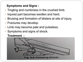 Symptoms and Signs :
• Tingling and numbness in the crushed limb.
• Injured part becomes swollen and hard.
• Bruising and formation of blisters at site of injury.
• Fractures may develop.
• Limb may become pale and pulseless.
• Symptoms and signs of shock.
Treatment :
 