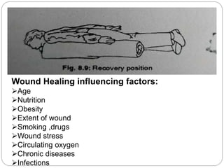 Wound Healing influencing factors:
Age
Nutrition
Obesity
Extent of wound
Smoking ,drugs
Wound stress
Circulating oxygen
Chronic diseases
Infections
 