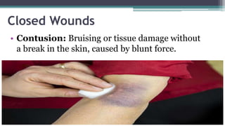 WOUNDS, wound healing process types of wounds.pptx