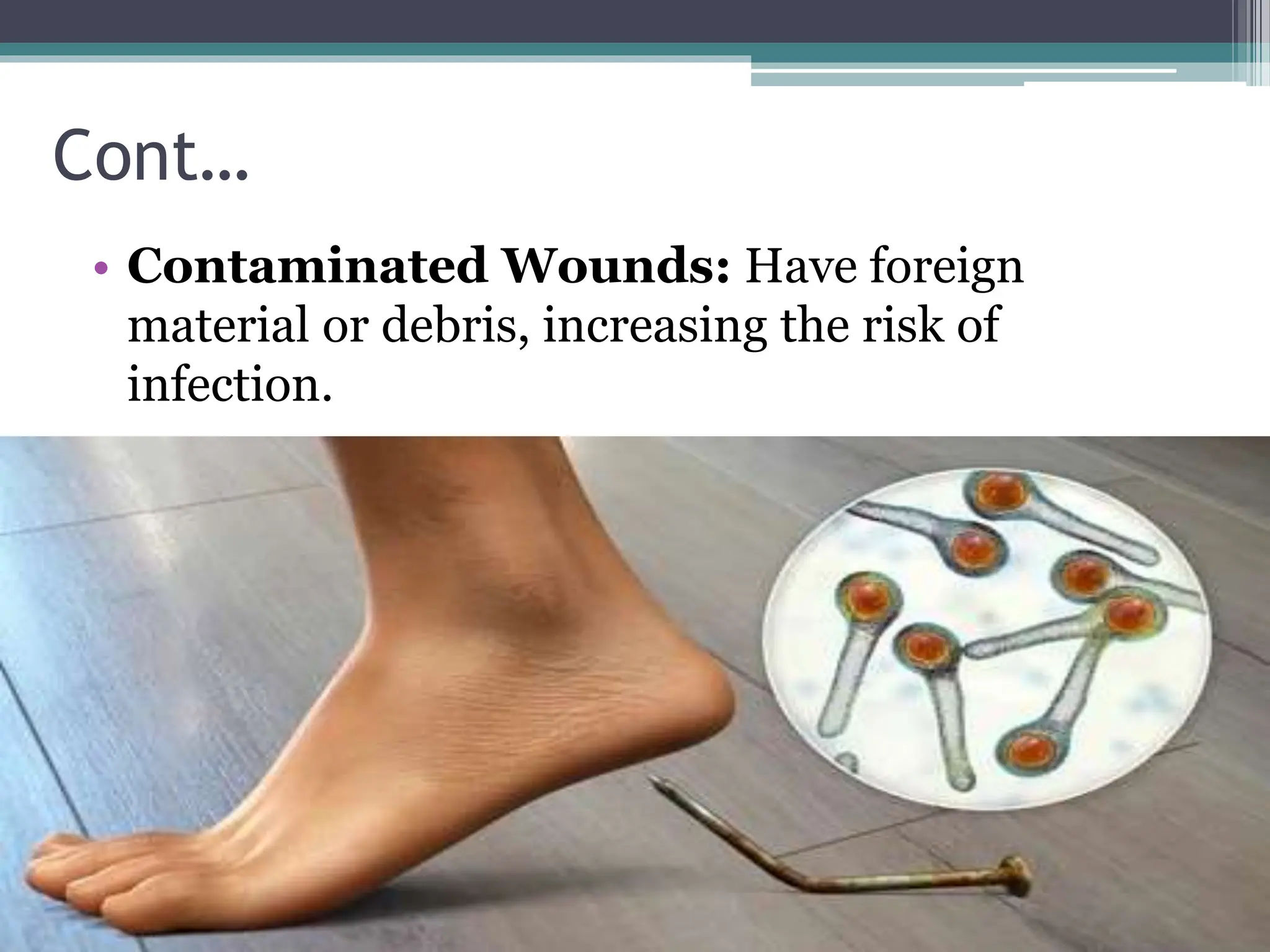 Cont…
• Contaminated Wounds: Have foreign
material or debris, increasing the risk of
infection.
 