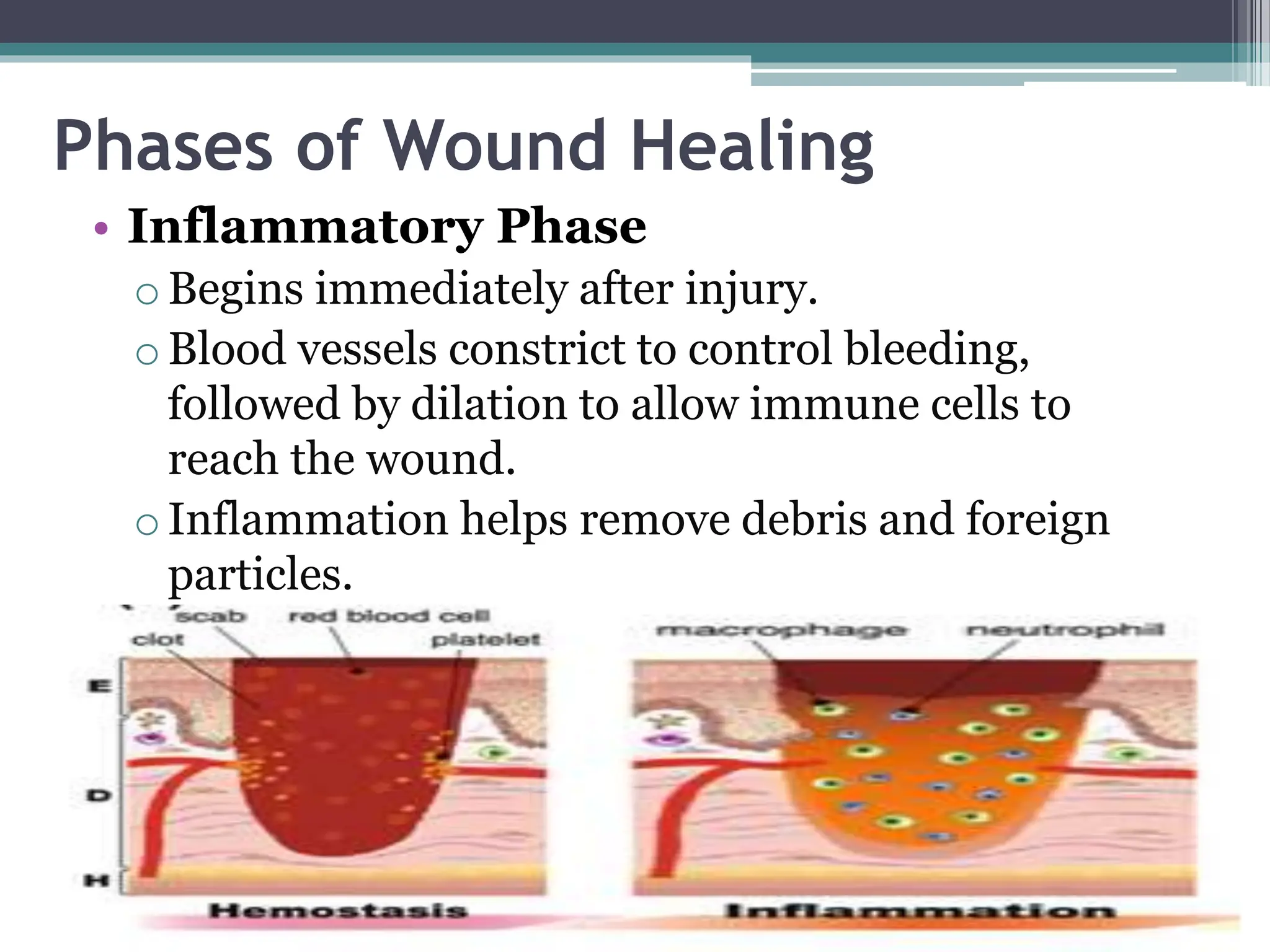 Phases of Wound Healing
• Inflammatory Phase
oBegins immediately after injury.
oBlood vessels constrict to control bleeding,
followed by dilation to allow immune cells to
reach the wound.
oInflammation helps remove debris and foreign
particles.
 