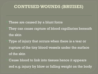 Wound dressing in nursing skills and first aid skills.pptx