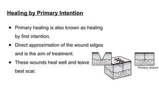 Approximated Incision Healing Ridge Comprehensive Overview of Wound Types, Healing Processes, and Closure ...