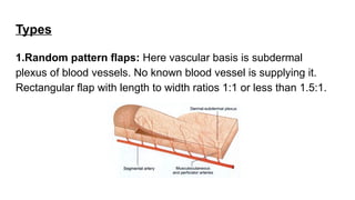 Random Pattern Flasps Comprehensive Overview of Wound Types, Healing Processes, and Closure ...