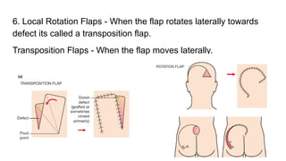 Transposition Vs Rotation Flap Comprehensive Overview of Wound Types, Healing Processes, and Closure ...