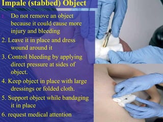 Impale (stabbed) Object
1. Do not remove an object
because it could cause more
injury and bleeding
2. Leave it in place and dress
wound around it
3. Control bleeding by applying
direct pressure at sides of
object.
4. Keep object in place with large
dressings or folded cloth.
5. Support object while bandaging
it in place
6. request medical attention
 