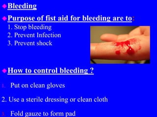 Bleeding
Purpose of fist aid for bleeding are to:
1. Stop bleeding
2. Prevent Infection
3. Prevent shock
How to control bleeding ?
1. Put on clean gloves
2. Use a sterile dressing or clean cloth
3. Fold gauze to form pad
 