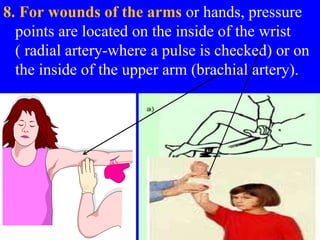 8. For wounds of the arms or hands, pressure
points are located on the inside of the wrist
( radial artery-where a pulse is checked) or on
the inside of the upper arm (brachial artery).
 