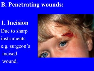 B. Penetrating wounds:
1. Incision
Due to sharp
instruments
e.g. surgeon’s
incised
wound.
 