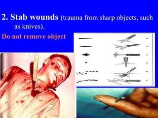 2. Stab wounds (trauma from sharp objects, such
as knives).
Do not remove object
 