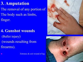 3. Amputation
The removal of any portion of
The body such as limbs,
finger.
4. Gunshot wounds
(Bullet injury)
(wounds resulting from
firearms).
 Entrance & exit wound of leg
 