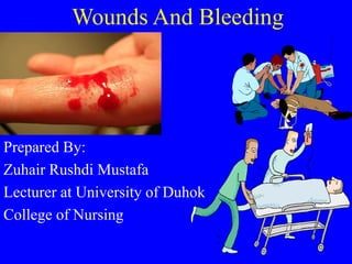 Prepared By:
Zuhair Rushdi Mustafa
Lecturer at University of Duhok
College of Nursing
Wounds And Bleeding
 