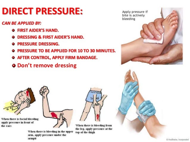 Image result for pressure bandage for bleeding