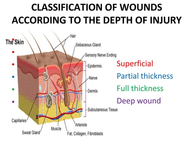 WOUNDS AND ULCERS-1.pptx | Death, Injury, or Military Conflict ...