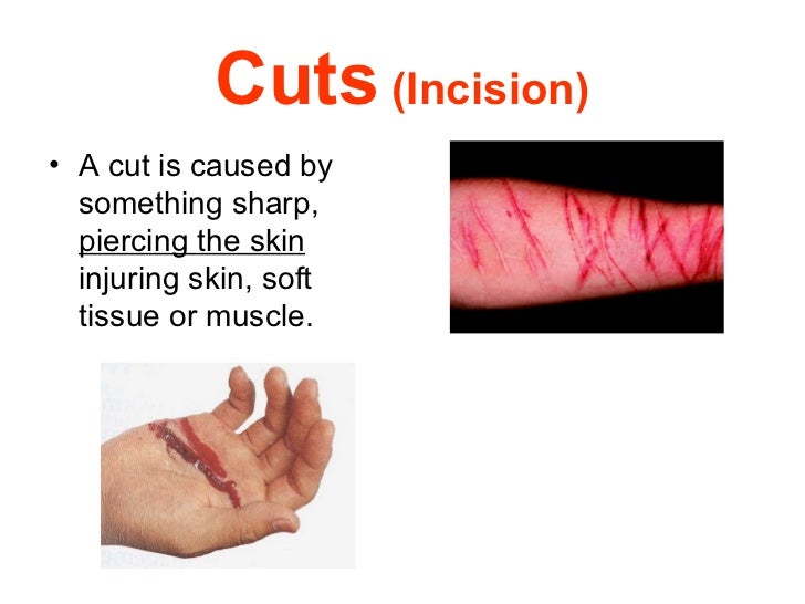 Wounds