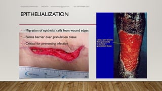 Comprehensive Guide to Wound Classification, Healing, and Management ...