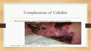 Comprehensive Guide to Wound Classification, Healing, and Management ...