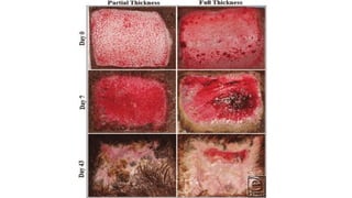 Comprehensive Guide to Wound Classification, Healing, and Management ...