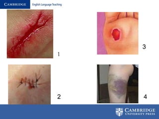 Wounds ,Charts and Medication: Tips for Teaching Nurses | PPT