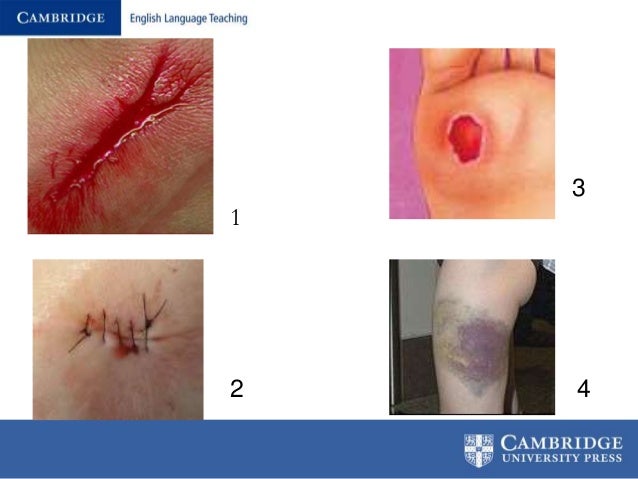 Wounds Charts And Medication Tips For Teaching Nurses