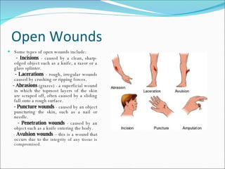 Open Wounds Some types of open wounds include:  - Incisions  - caused by a clean, sharp-edged object such as a knife, a razor or a glass splinter.  - Lacerations  - rough, irregular wounds caused by crushing or ripping forces.  - Abrasions  (grazes) - a superficial wound in which the topmost layers of the skin are scraped off, often caused by a sliding fall onto a rough surface.  - Puncture wounds  - caused by an object puncturing the skin, such as a nail or needle.  - Penetration wounds  - caused by an object such as a knife entering the body.  -  Avulsion wounds  – this is a wound that occurs due to the  integrity of any tissue is compromised. 