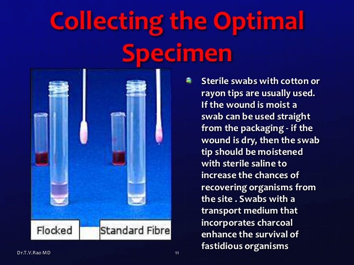 Wound Swabs basics