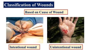 Contiguous Wound Wounds & Wound Assessment in nursing.pdf
