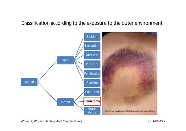 High Risk Wund Example Wounds, Wound Healing And Complications | PDF | First Aid | Injuries