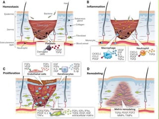 Wound, tissue repair and scar | PDF