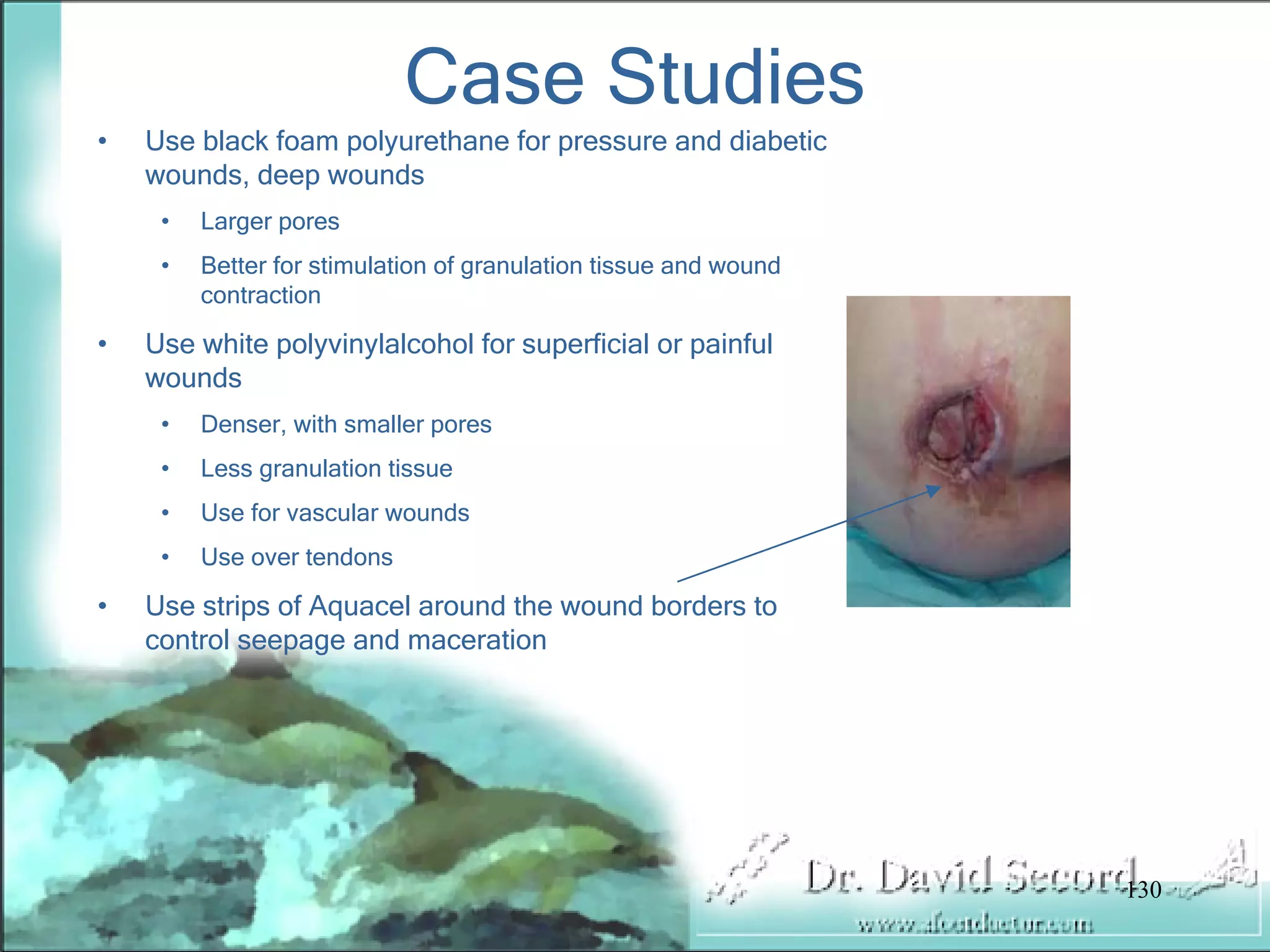 Wound Vac Lecture