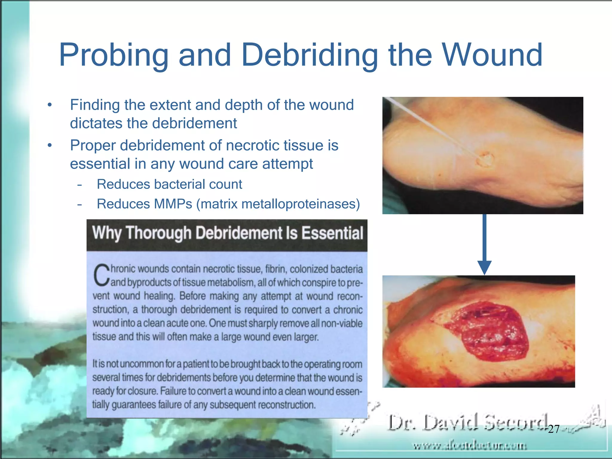 Wound Vac Lecture