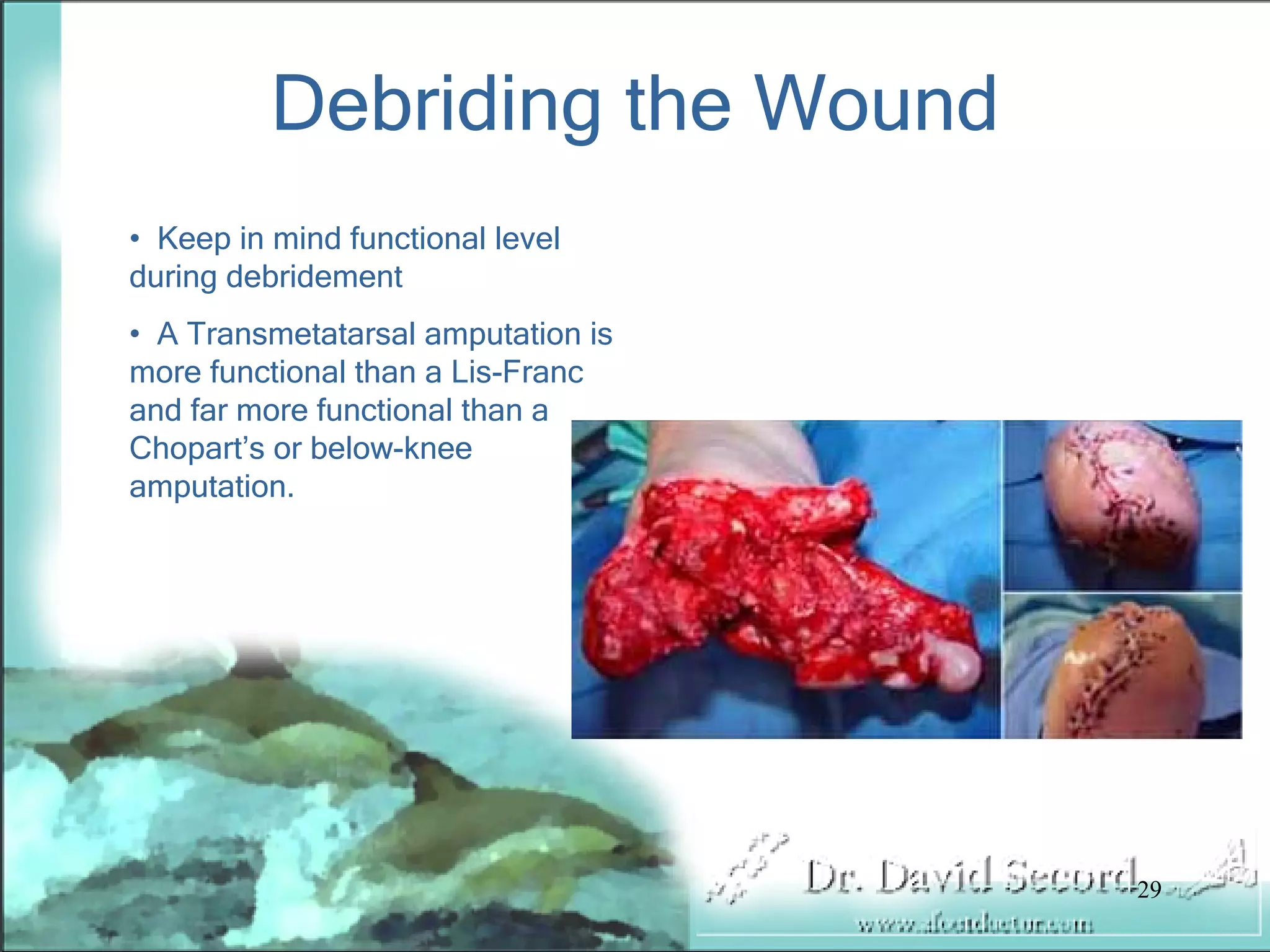 Wound Vac Lecture