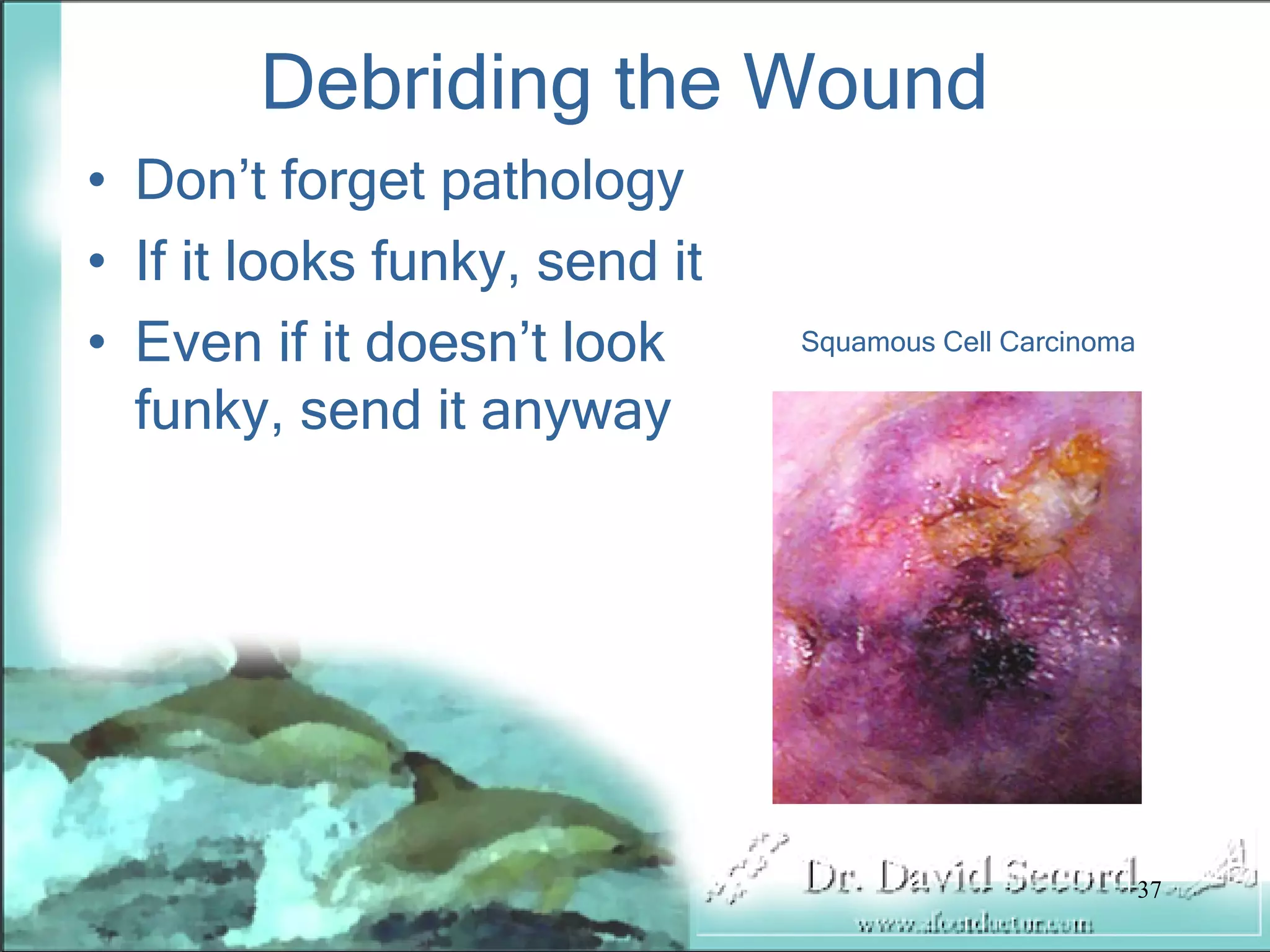 Wound Vac Lecture