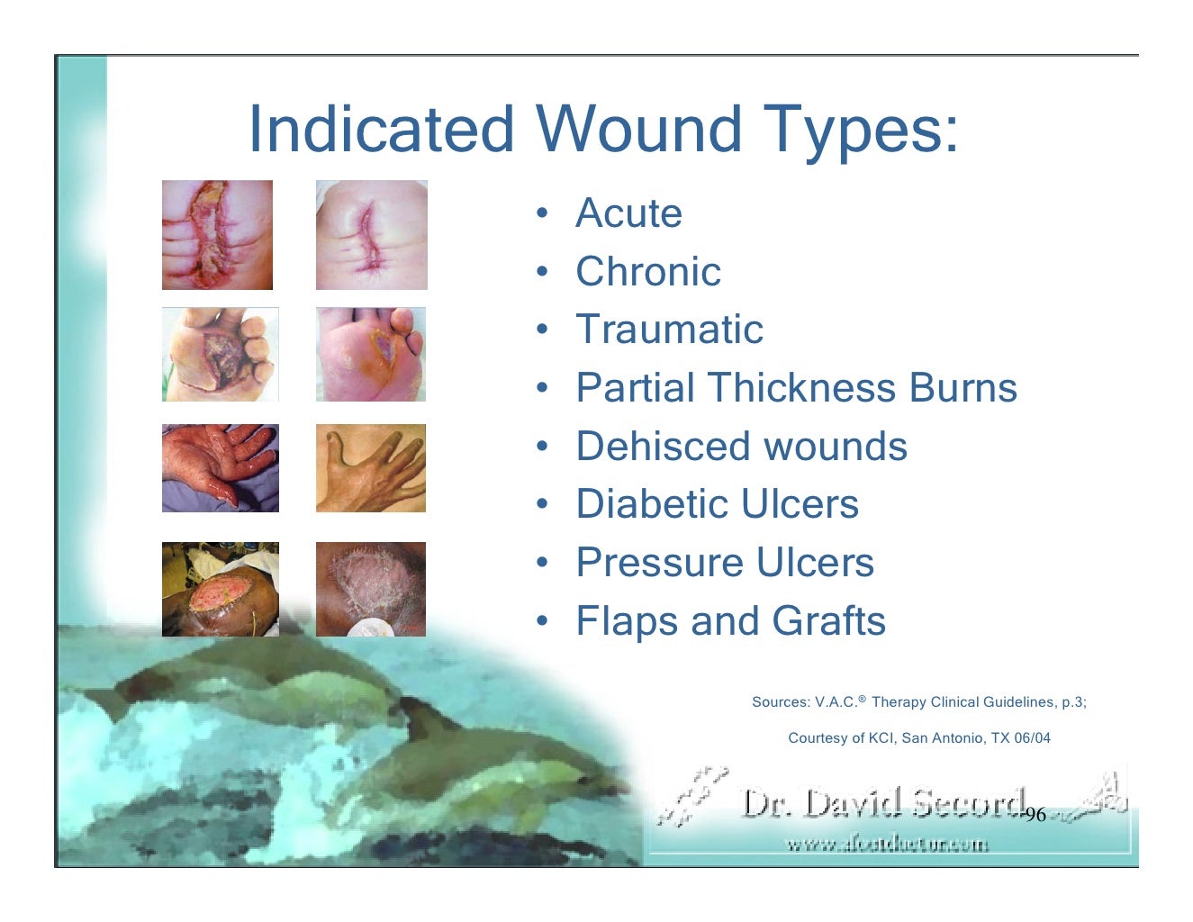Wound Vac Lecture
