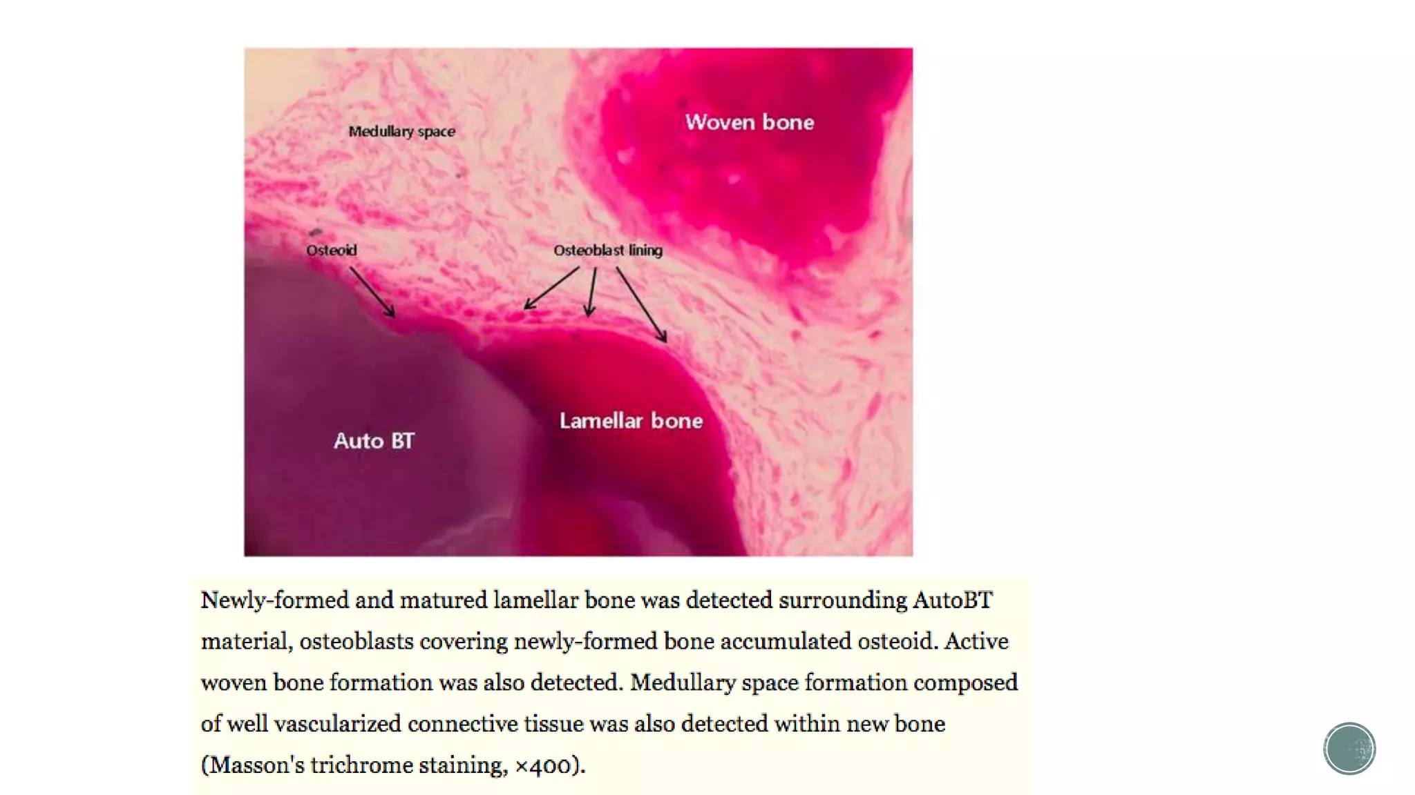 Difference between Woven bone and Lamellar bone | PPTX