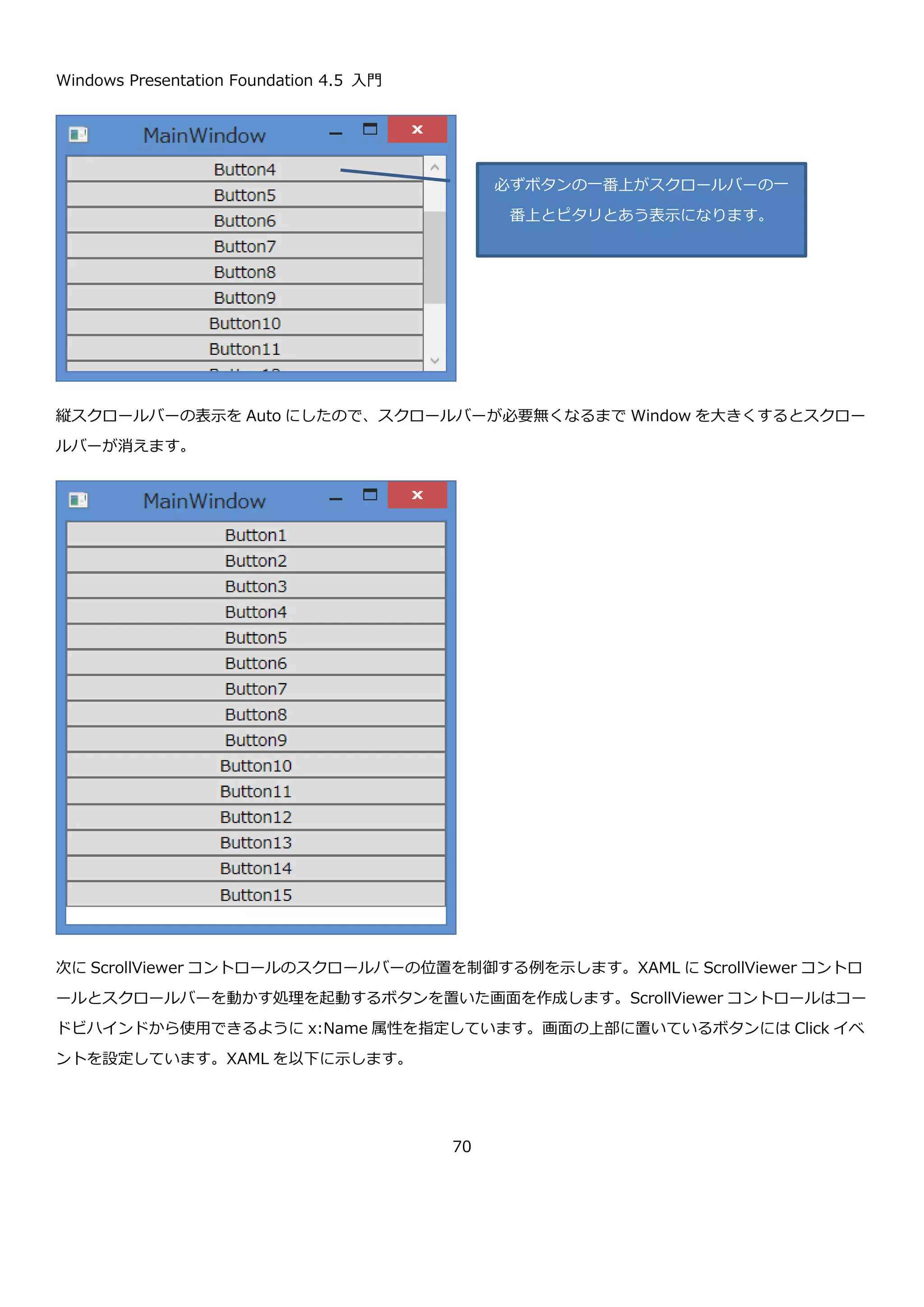 Windows Presentation Foundation 4.5 入門
70
void ScrollToVerticalOffset(double offset) offset で指定した場所まで垂直スクロールします。
ScrollViewer コントロールには、この他にも行単位のスクロールを制御する Line****メソッドやページ単位のスク
ロールを制御する Page****メソッド(****にはスクロール方向が入ります)や、タッチ操作にどう対応するかを設
定するプロパティなどがあります。詳細は、MSDN の ScrollViewer コントロールのページを確認してください。
ScrollViewer コントロール
http://msdn.microsoft.com/ja-jp/library/ms612678.aspx
ScrollViewer コントロールを使ってスクロールする画面を作成する XAML の例を以下に示します。
実行するとボタンが縦にならんで縦スクロールバーがある Window が表示されます。デフォルトでは物理スクロー
ルなので、下図のようにボタンの途中でスクロールバーを止めることができます。
<Window x:Class="ScrollViewerSample01.MainWindow"
xmlns="http://schemas.microsoft.com/winfx/2006/xaml/presentation"
xmlns:x="http://schemas.microsoft.com/winfx/2006/xaml"
Title="MainWindow" Height="200" Width="300">
<ScrollViewer>
<StackPanel>
<Button Content="Button1" />
<Button Content="Button2" />
<Button Content="Button3" />
<Button Content="Button4" />
<Button Content="Button5" />
<Button Content="Button6" />
<Button Content="Button7" />
<Button Content="Button8" />
<Button Content="Button9" />
<Button Content="Button10" />
<Button Content="Button11" />
<Button Content="Button12" />
<Button Content="Button13" />
<Button Content="Button14" />
<Button Content="Button15" />
</StackPanel>
</ScrollViewer>
</Window>
 