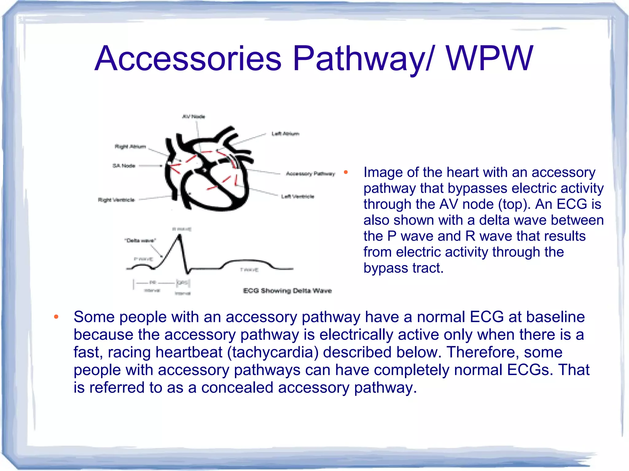 Accessories Pathway/WPW | PPT