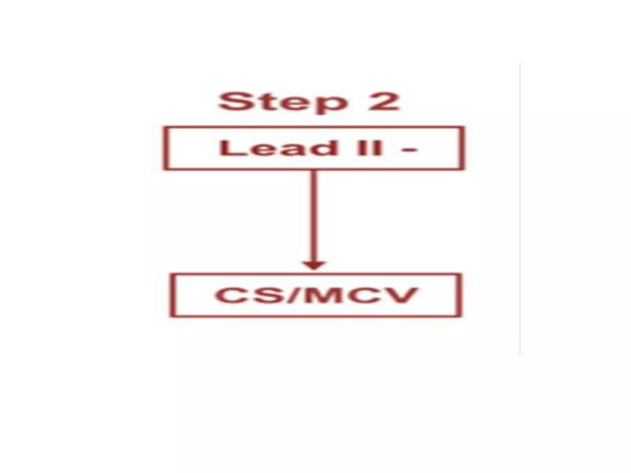 Localization of WPW( accessory Pathway) by surface ECG | PPTX