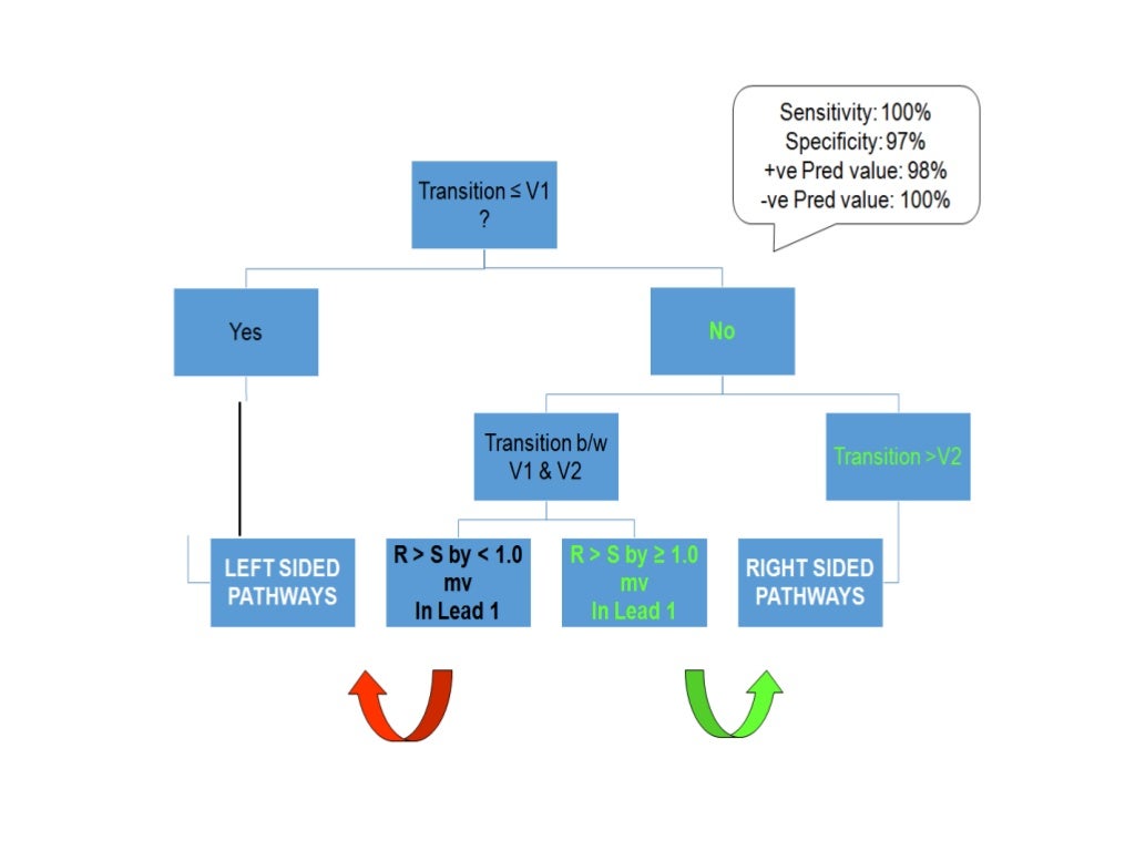 Localization of WPW( accessory Pathway) by surface ECG
