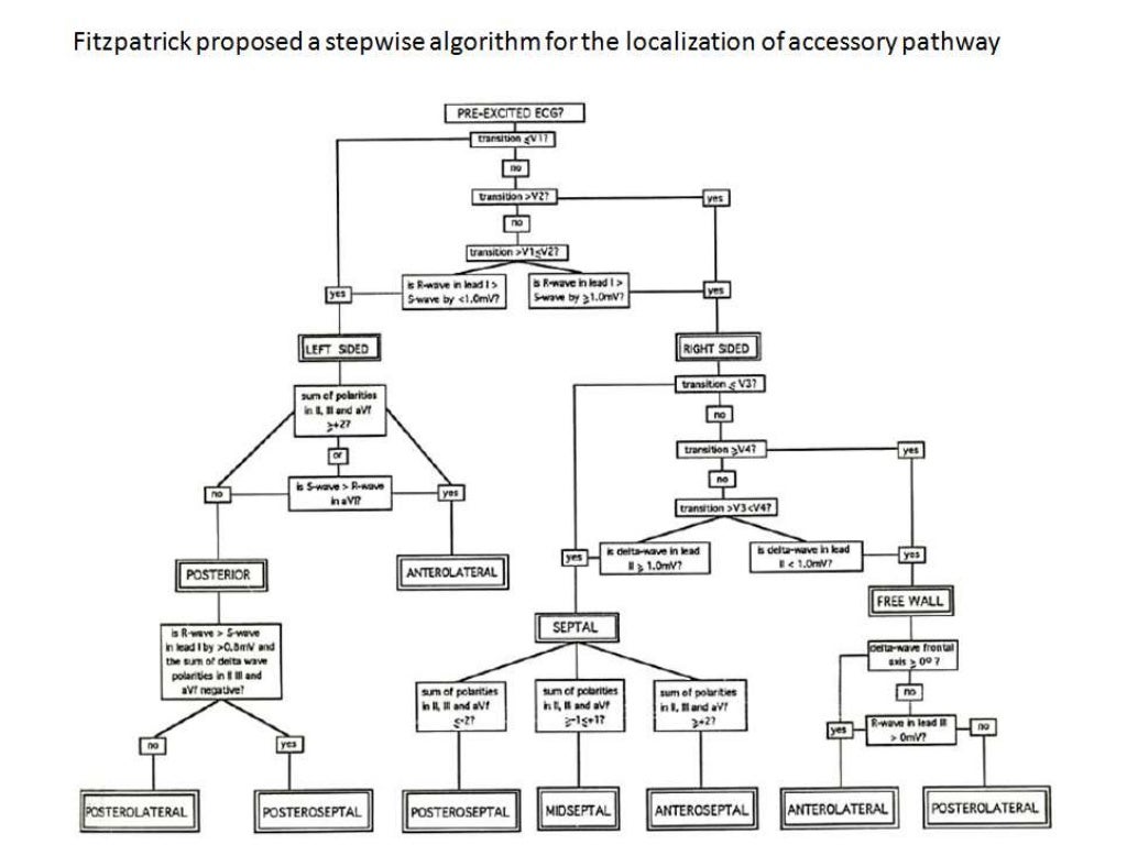 Localization of WPW( accessory Pathway) by surface ECG