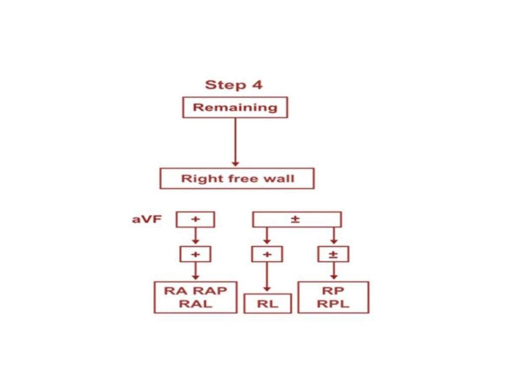 Localization of WPW( accessory Pathway) by surface ECG