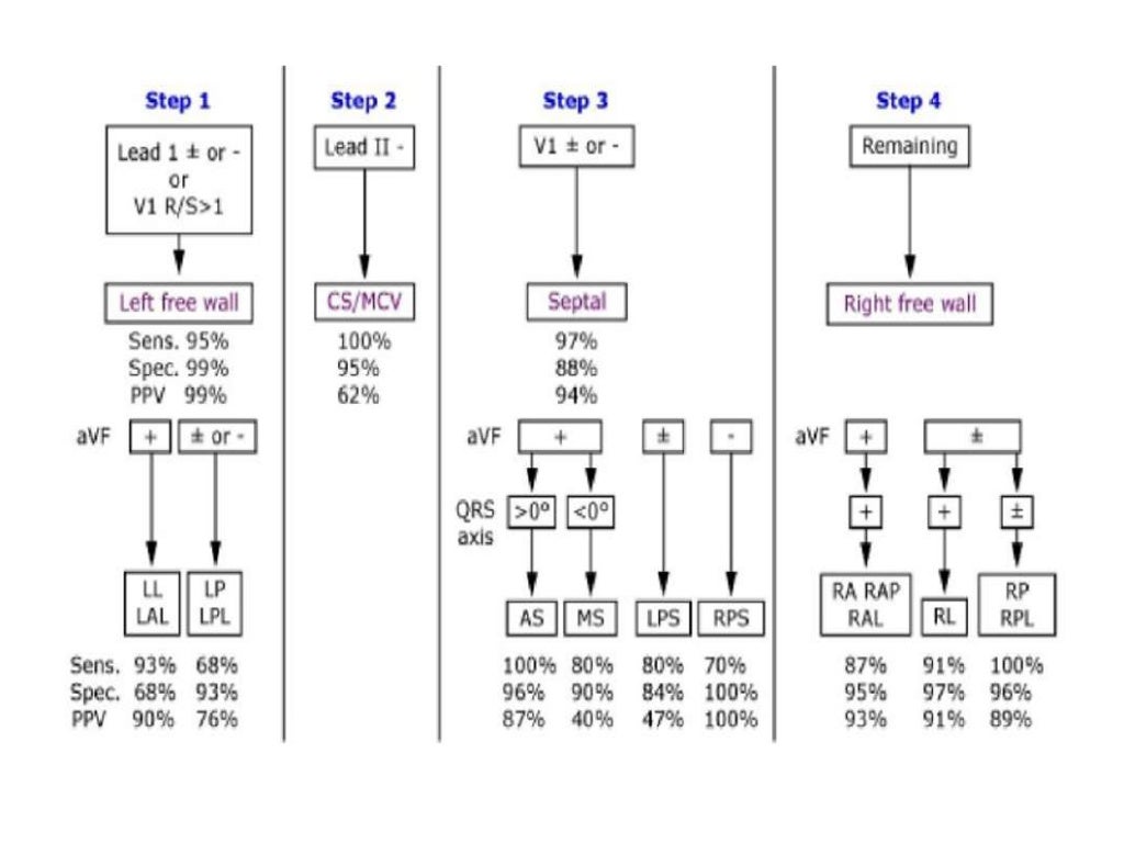 Localization of WPW( accessory Pathway) by surface ECG