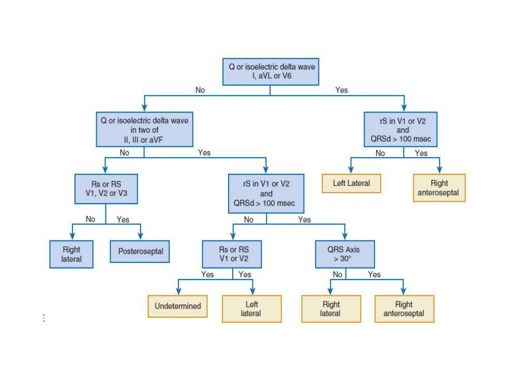 Localization of WPW( accessory Pathway) by surface ECG