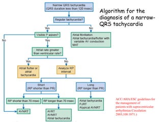 ECG localization of accessory pathways slideshare | PPTX