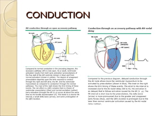 CONDUCTIONCONDUCTION
 