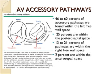  46 to 60 percent of
accessory pathways are
found within the left free
wall space
 25 percent are within
the posteroseptal space
 13 to 21 percent of
pathways are within the
right free wall space
 2 percent are within the
anteroseptal space
AV ACCESSORY PATHWAYSAV ACCESSORY PATHWAYS
 