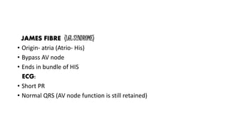 JAMES FIBRE (LGL SYNDROME)
• Origin- atria (Atrio- His)
• Bypass AV node
• Ends in bundle of HIS
ECG:
• Short PR
• Normal QRS (AV node function is still retained)
 